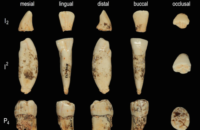 Colección de dientes de antecessor, con 800.000 años de antigüedad. De una esquirla se extrajo una secuencia de aminoácidos.