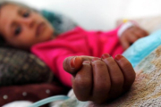 Una niña con desnutricion recibe tratamiento medico en la sala de emergencias de un hospital de Saná.-EFE / YAHYA ARHAB