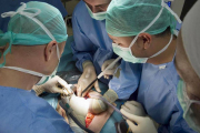 Varios médicos atienden una intervención quirúrgica en una imagen de archivo.-ECB