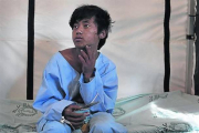 Curado 8Pemba, después de haber sido atentido en el hospital.-AP