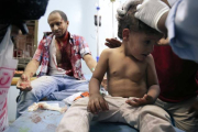 Un niño yemení recibe tratamiento tras resultar heridos en los combates.-AFP / AHMAD AL-BASHA