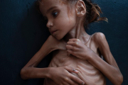 La niña Amal, fallecida por desnutrición-TYLER HICKS (THE NEW YORK TIMES)