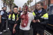 Uno de los heridos en la Escola Mediterrànea de la Barceloneta durante las cargas policiales el 1-O.-EL PERIÓDICO