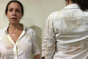 Machado se encontraba en la localidad de Upata cuando fue abordada por sujetos que la atacaron a golpes y empujones.-EFE