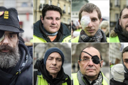 Algunos de los manifestantes chalecos amarillos que acusan a la policía francesa de sus heridas.-FRANCE PRESS