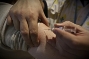 Se aplicarán vacunas para prevenir el sarampión.-DANNY CAMINAL
