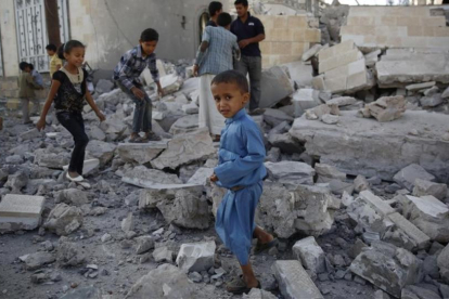 Más de 320.000 niños padecen malnutrición severa en Yemen.-Hani Mohammed