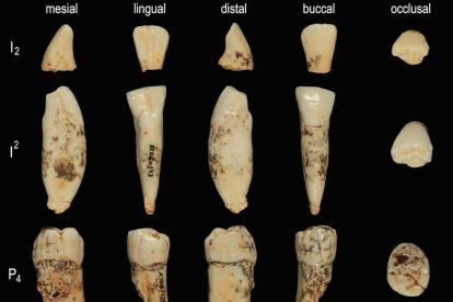 Colección de dientes de antecessor, con 800.000 años de antigüedad. De una esquirla se extrajo una secuencia de aminoácidos.