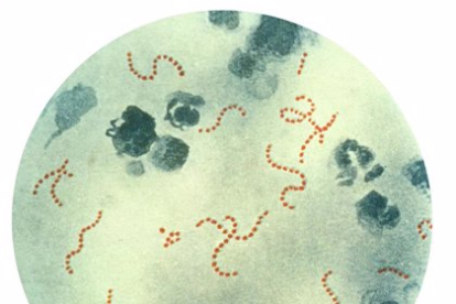 Bacteria estreptococo. EUROPA PRESS
