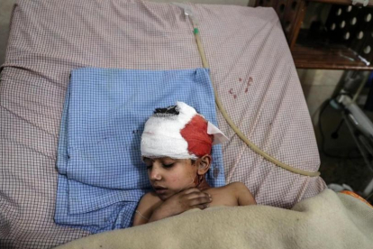 Un niño herido en los bombardeos de las fuerzas leales a Damasco recibe tratamiento en un hospital de Duma.-EFE / MOHAMMED BADRA