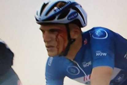 Marcel Kittel, con la cara ensangrentada en el Tour de Dubái, tras recibir un codazo de Andriy Grivko.-