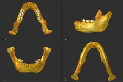 Reconstrucción virtual de la mandíbula de Montmaurin-La Niche. Vista oclusal (superior izquierda); vista lateral (superior derecha); vista anterior (inferior izquierda); vista inferior (inferior derecha).  Marina Martínez de Pinillos.