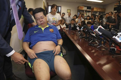 Howard Lam, con la camiseta del Barça, expone las heridas de sus piernas en una conferencia en Hong Kong el viernes 11 de agosto.-EL PERIÓDICO