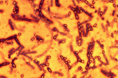 Esporas de la bacteria Bacilus antracis, que causa el ántrax, en una imagen de archivo.-AFP / MOSCÚ