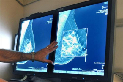 Un radiólogo compara dos mamografías para detectar tumores.-/ AP