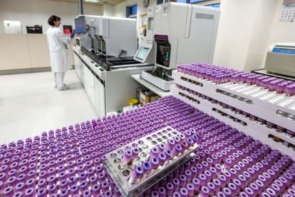 Los tubos de sangre que las enfermeras extraen en el Centro de Salud acaban en este Laboratorio de análisis del servicio de Hematología del HUBU.