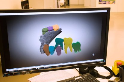 Los dientes, igual que las mandíbulas de fósiles de homínidos extintos y de cientos de miles de años, se escanean. Estos dientes de leche pueden estar entre una hora y 29 minutos. TOMÁS ALONSO