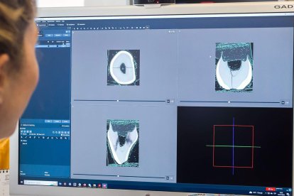 Se reconstruye el interior y el exterior del diente. Se obtiene una escala infinita de grises y los técnicos tienen que dotar de color. De cada pieza de dientes del Ratón Pérez, se obtienen más de mil imágenes. TOMÁS ALONSO