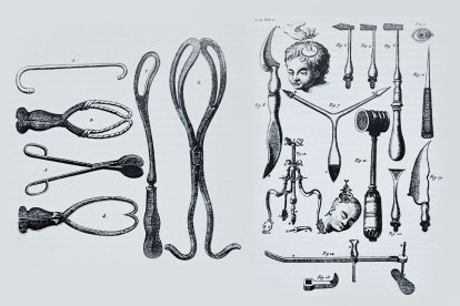 Instrumental médico y quirúrgico que se utilizaba a principios del siglo XIX.