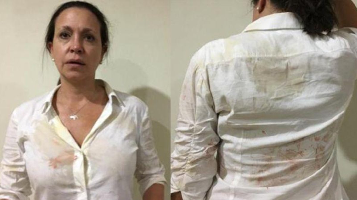 Machado se encontraba en la localidad de Upata cuando fue abordada por sujetos que la atacaron a golpes y empujones.-EFE