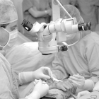 Operación con microcirugia-MONTSE ÁLVAREZ