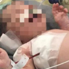 El pequeño Arthur en el hospital de Río de Janeiro.-