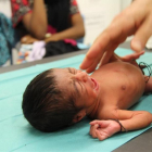 Uno de los bebés.-MSF