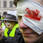 Los chalecos amarillos, con heridas falsas en los ojos, durante una manifestación.-SEBASTIEN BOZON (AFP)