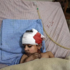 Un niño herido en los bombardeos de las fuerzas leales a Damasco recibe tratamiento en un hospital de Duma.-EFE / MOHAMMED BADRA