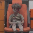Un niño sirio que sobrevive a un bombardeo aguarda en una ambulancia.-TWITTER