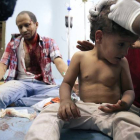 Un niño yemení recibe tratamiento tras resultar heridos en los combates.-AFP / AHMAD AL-BASHA