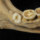 Cuarto molar localizado en la mandíbula extraída de uno de los enterramientos colectivos de El Mirador.-IPHES