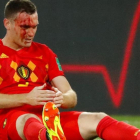 Vermaelen sangra tras una jugada en el partido ante Inglaterra.-REUTERS