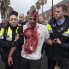 Uno de los heridos en la Escola Mediterrànea de la Barceloneta durante las cargas policiales el 1-O.-EL PERIÓDICO