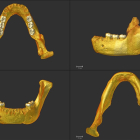 Reconstrucción virtual de la mandíbula de Montmaurin-La Niche. Vista oclusal (superior izquierda); vista lateral (superior derecha); vista anterior (inferior izquierda); vista inferior (inferior derecha).  Marina Martínez de Pinillos.