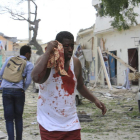Un herido en el ataque al hotel Dayah de Mogadiscio.-FARAH ARBI WARSAMEH / AP