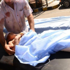 Traslado de una niña siria herida.-AFP / GEORGES OURFALIAN