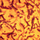 Esporas de la bacteria Bacilus antracis, que causa el ántrax, en una imagen de archivo.-AFP / MOSCÚ