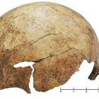 Cráneo de un niño encontrado en el yacimiento paleolítico de Schöneck-Kilianstädten, en Alemania, con restos evidentes de haber sido golpeado violentamente.-Foto: PNAS