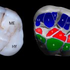 Molar superior de la Sima de los Huesos (izquierda): ejemplar AT-3177. A la derecha, modelo 3D muestra las zonas de desgaste dental generadas durante la masticación.
