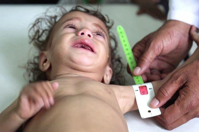 Niña yemení.-MOHAMMED AWADH (SAVE THE CHILDREN)