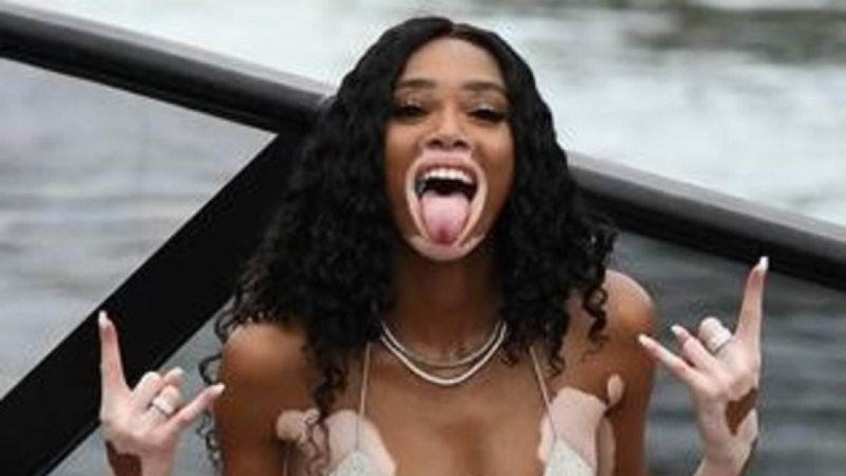 La modelo Winnie Harlow, durante su fiesta de cumpleaños en Miami.-MEGA