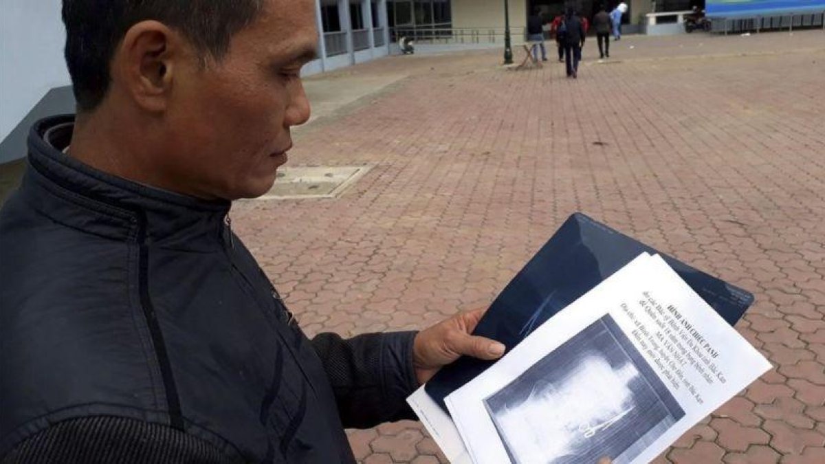 El paciente Ma Van Nhat muestra la radiografía donde se aprecia las tijeras en el interior de su cuerpo.-EFE