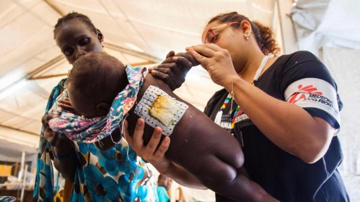 Una enfermera examina a una niña que sufre una infección en la piel, en el hospital de MSF de Malakal (Sudán del Sur), el 15 de junio.-AFP / ALBERT GONZALEZ FARRAN