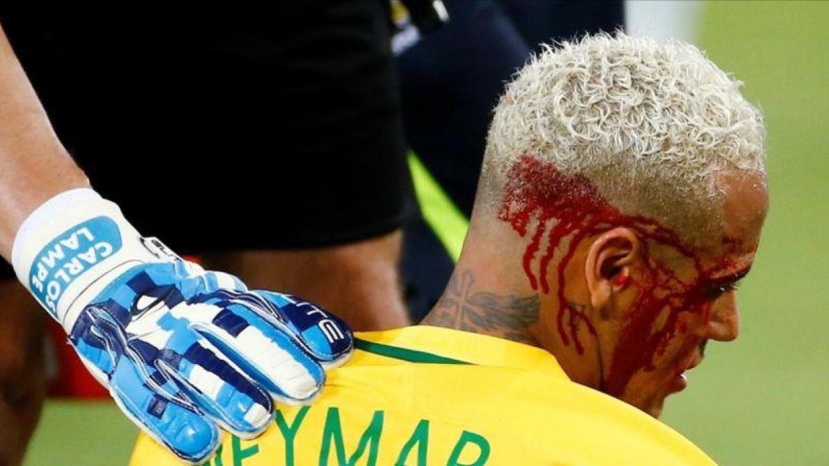 Neymar, tras recibir el codazo ante Bolivia.-REUTERS / RICARDO MORAES