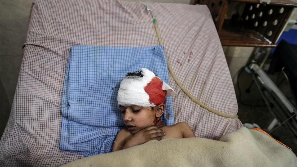Un niño herido en los bombardeos de las fuerzas leales a Damasco recibe tratamiento en un hospital de Duma.-EFE / MOHAMMED BADRA