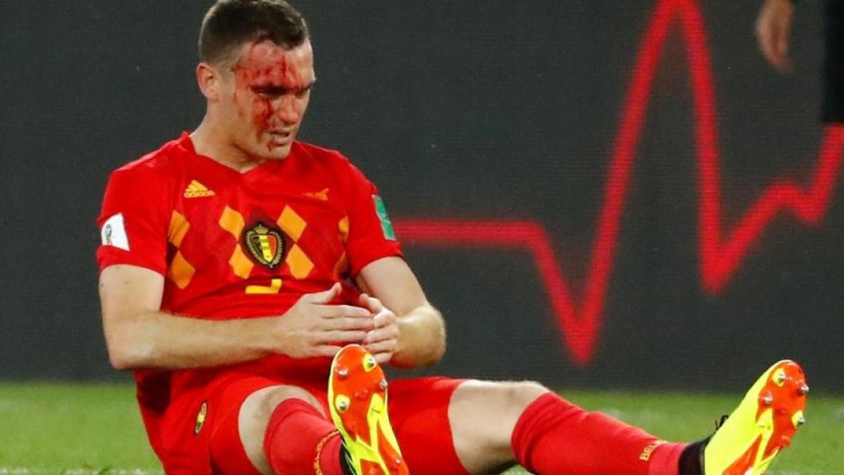 Vermaelen sangra tras una jugada en el partido ante Inglaterra.-REUTERS