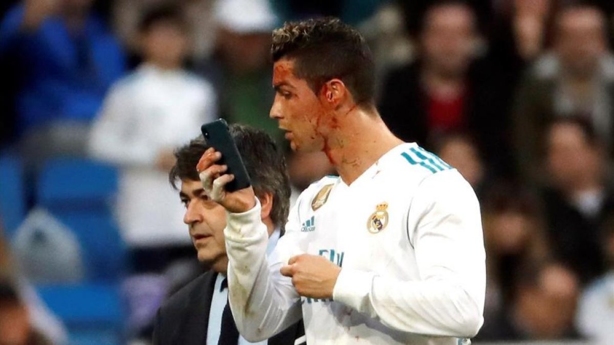 Cristiano abandona el césped del Bernabéu mirándose la brecha en la ceja en el móvil del médico.-EFE / JUAN CARLOS HIDALGO