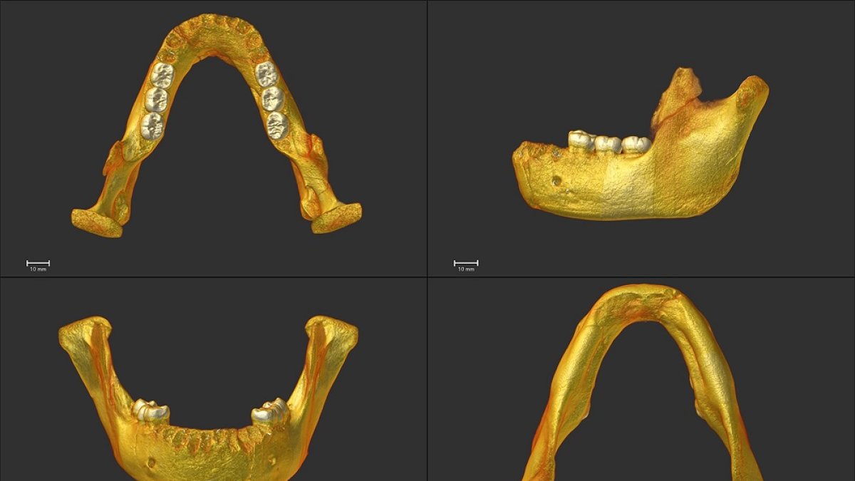 Reconstrucción virtual de la mandíbula de Montmaurin-La Niche. Vista oclusal (superior izquierda); vista lateral (superior derecha); vista anterior (inferior izquierda); vista inferior (inferior derecha). Marina Martínez de Pinillos.