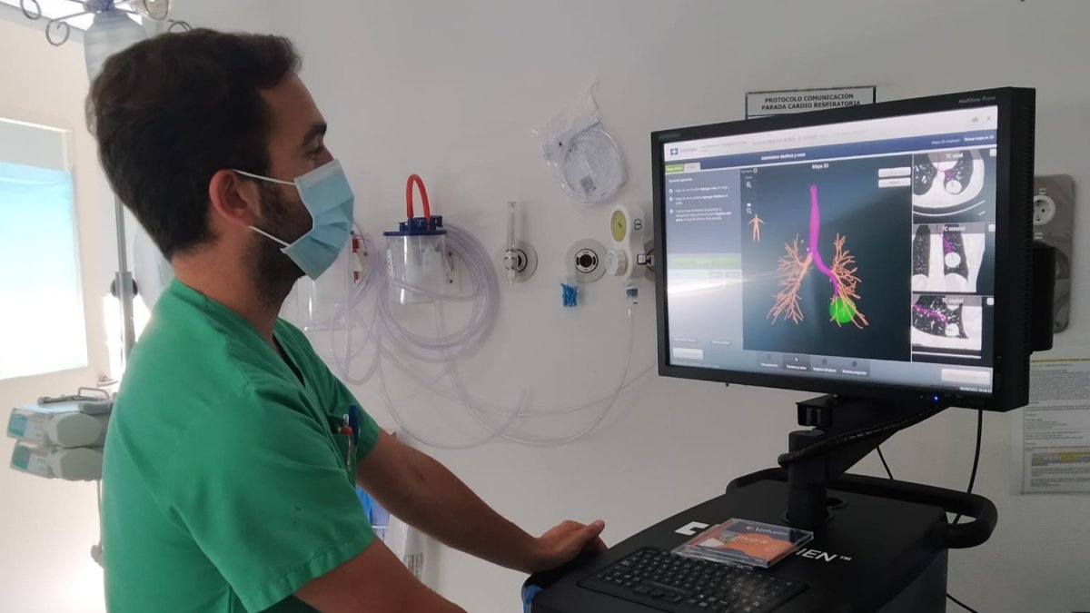 El HUBU potencia las técnicas diagnósticas en neumología con un broncoscopio de navegación electromagnética. ECB
